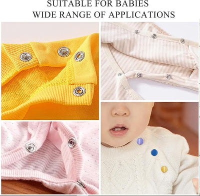 Zyntric™ Metal Button Fastening Kit