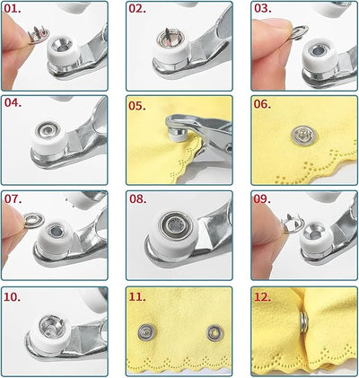 Zyntric™ Metal Button Fastening Kit